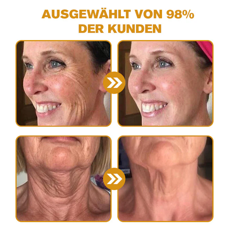 🏆Letzter Tag der Aktion: 70 % Rabatt - ✨Furzero™ Botox Bienenvenom Faltenentfernungscreme - Image 3