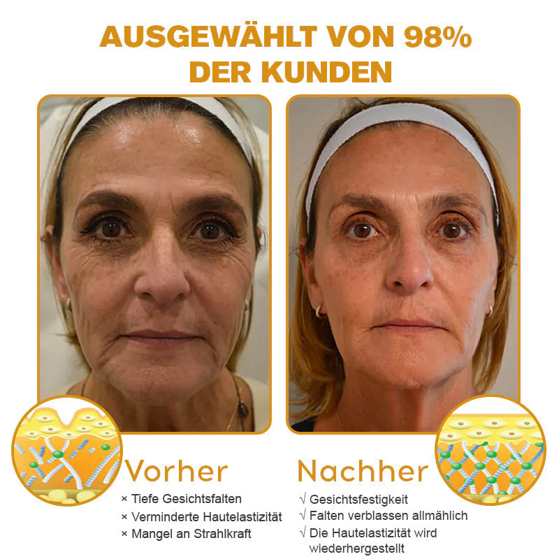 🏆Letzter Tag der Aktion: 70 % Rabatt - ✨Furzero™ Botox Bienenvenom Faltenentfernungscreme - Image 4