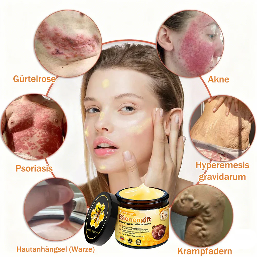 🌟Hergestellt und versendet aus Deutschland💖 Ourlyard® Bienengift Hautregenerationscreme 🔥 LETZTER TAG 80 % RABATT 🌟 - Image 10