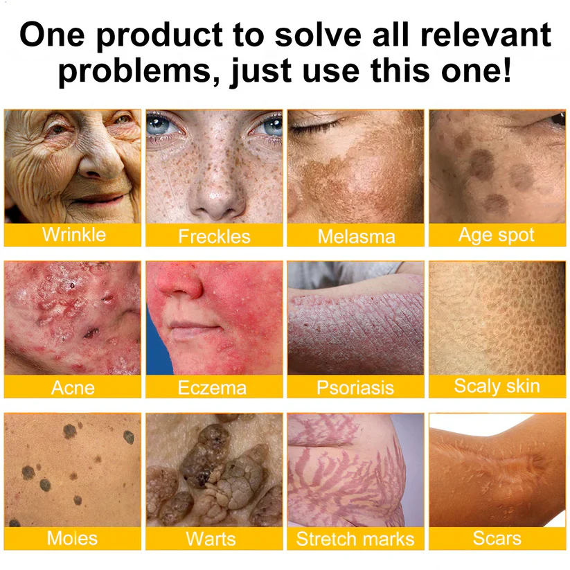 🌟Hergestellt und versendet aus Deutschland💖 Ourlyard® Bienengift Hautregenerationscreme 🔥 LETZTER TAG 80 % RABATT 🌟 - Image 2