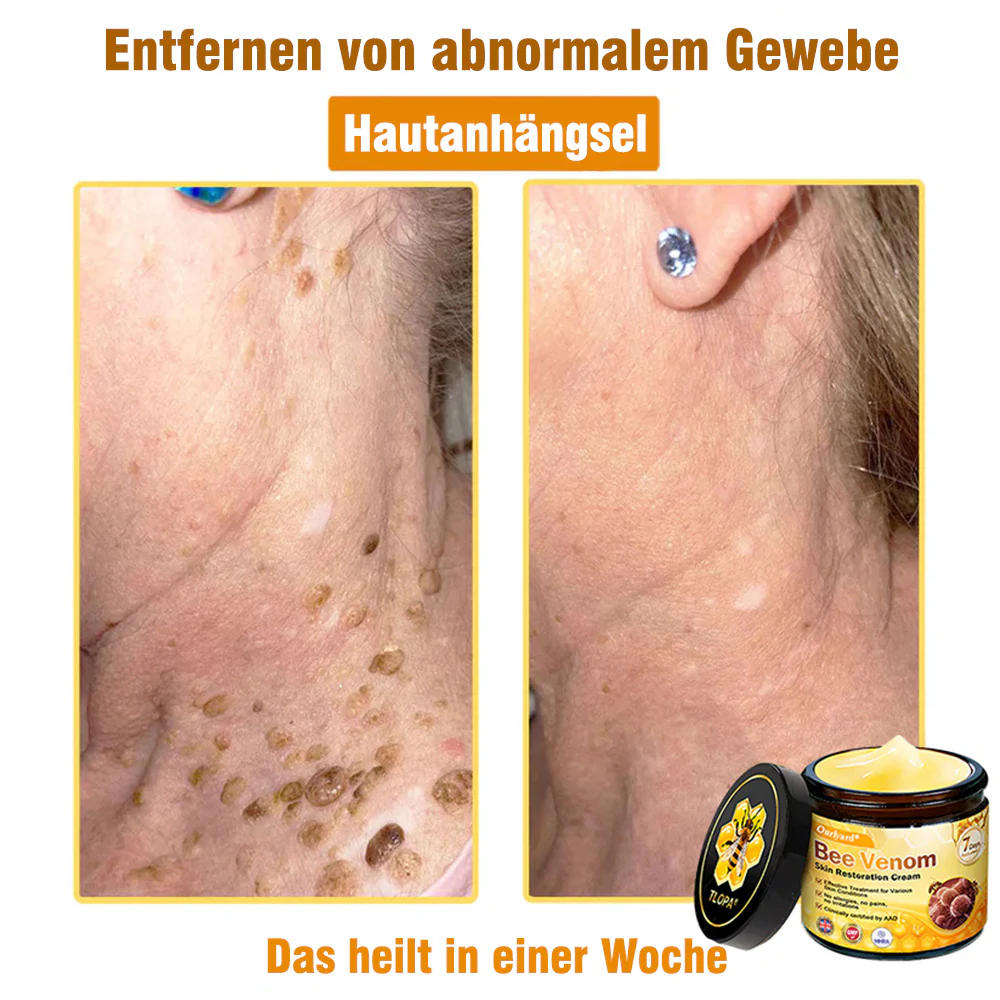 🌟Hergestellt und versendet aus Deutschland💖 Ourlyard® Bienengift Hautregenerationscreme 🔥 LETZTER TAG 80 % RABATT 🌟 - Image 4