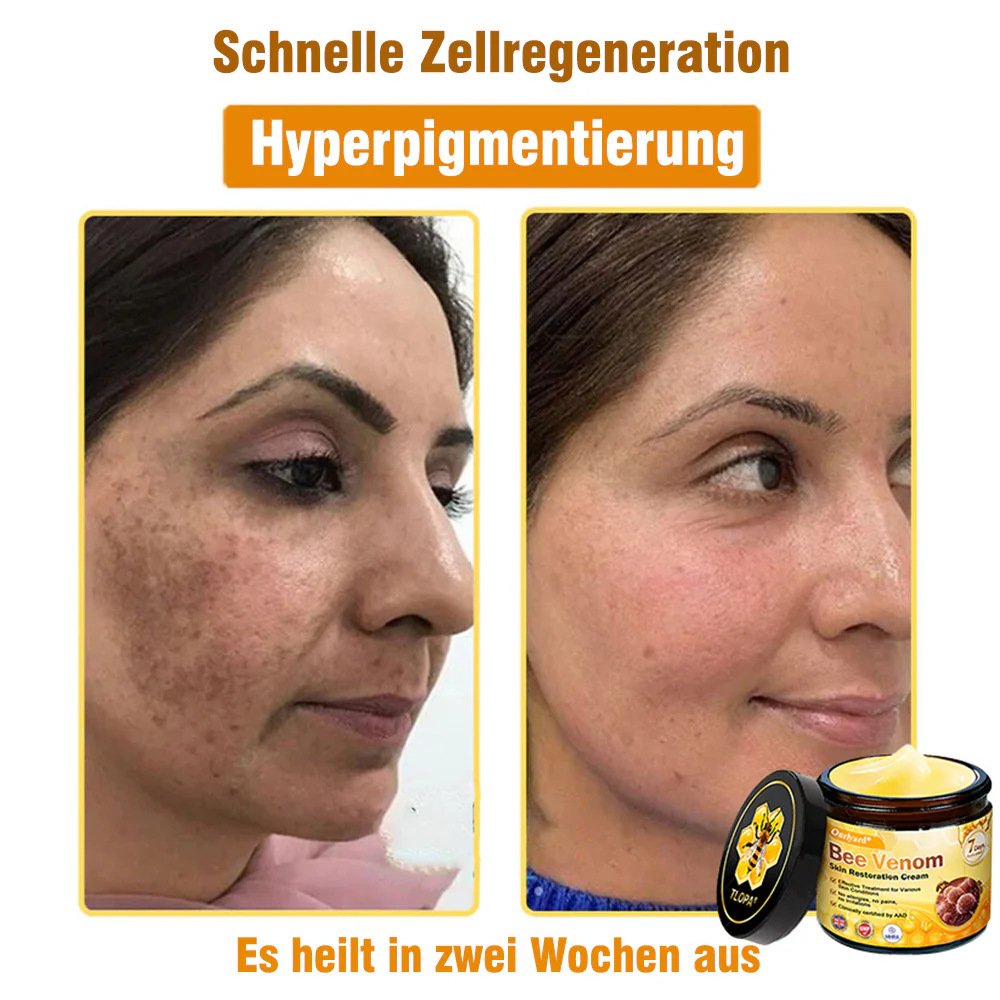 🌟Hergestellt und versendet aus Deutschland💖 Ourlyard® Bienengift Hautregenerationscreme 🔥 LETZTER TAG 80 % RABATT 🌟 - Image 5