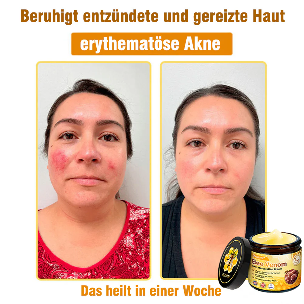🌟Hergestellt und versendet aus Deutschland💖 Ourlyard® Bienengift Hautregenerationscreme 🔥 LETZTER TAG 80 % RABATT 🌟 - Image 6