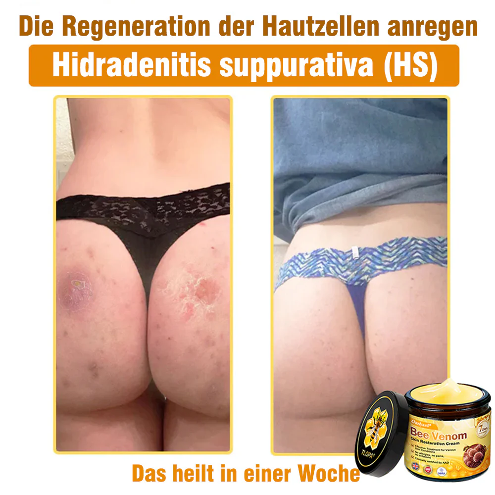 🌟Hergestellt und versendet aus Deutschland💖 Ourlyard® Bienengift Hautregenerationscreme 🔥 LETZTER TAG 80 % RABATT 🌟 - Image 7
