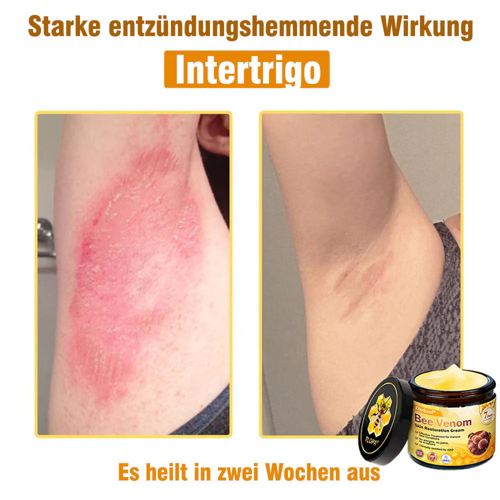 🌟Hergestellt und versendet aus Deutschland💖 Ourlyard® Bienengift Hautregenerationscreme 🔥 LETZTER TAG 80 % RABATT 🌟 - Image 8