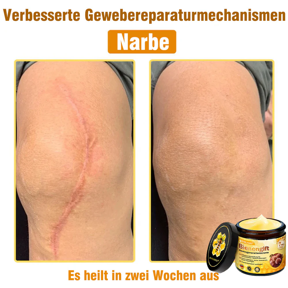 🌟Hergestellt und versendet aus Deutschland💖 Ourlyard® Bienengift Hautregenerationscreme 🔥 LETZTER TAG 80 % RABATT 🌟 - Image 9