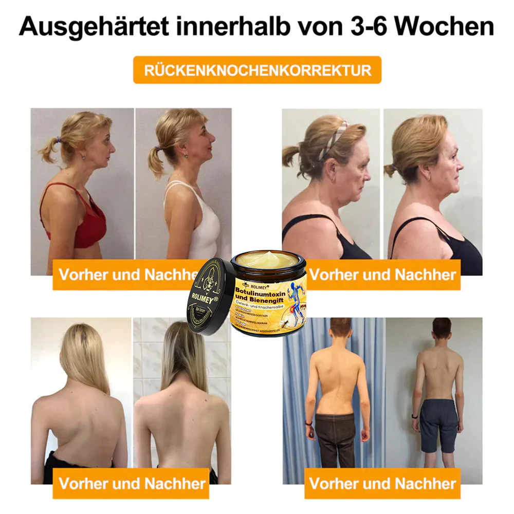 ✅ Offizieller Shop: Rolimey® Bienengift-Schmerzlinderungs Knochenheilungs Creme 👨‍⚕️(Reduzierung von Gelenkschwellungen, Schmerzen, Steifheit, Rötungen, Wärme, Muskelkater und Gelenkmüdigkeit) - Image 4