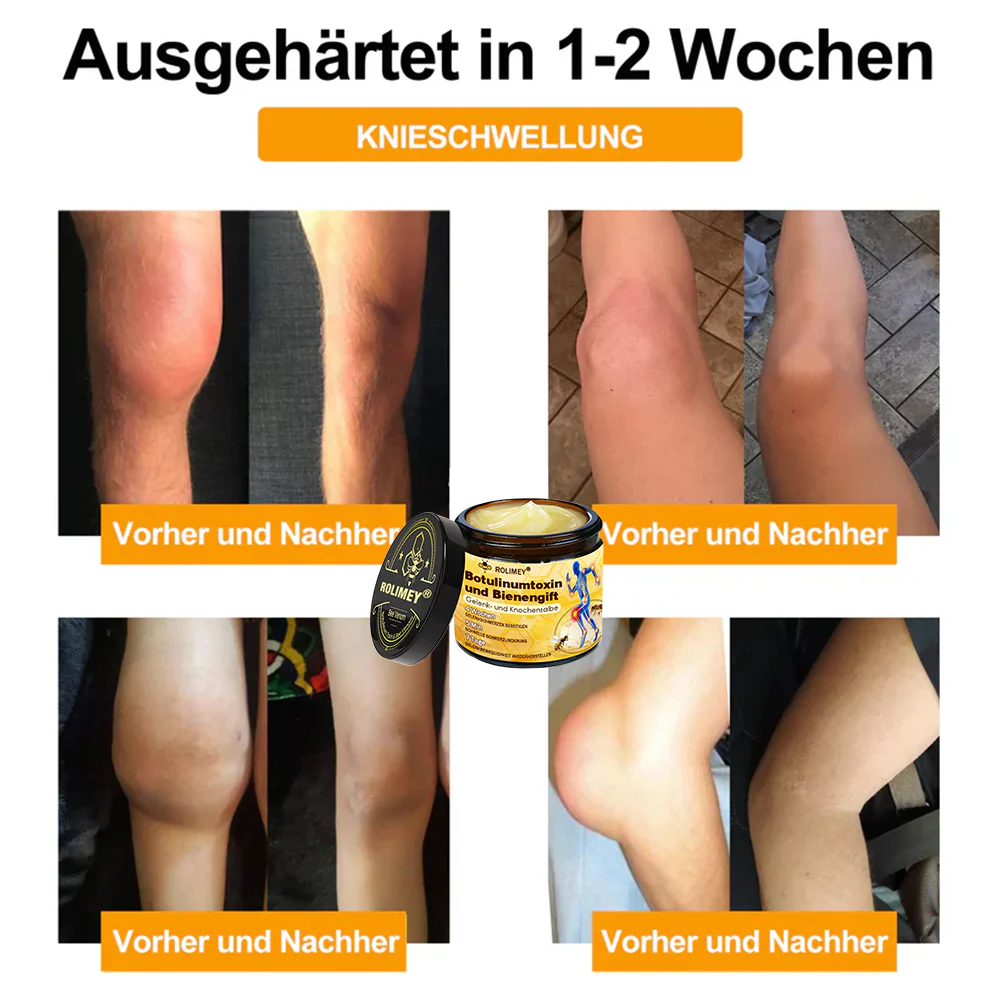 ✅ Offizieller Shop: Rolimey® Bienengift-Schmerzlinderungs Knochenheilungs Creme 👨‍⚕️(Reduzierung von Gelenkschwellungen, Schmerzen, Steifheit, Rötungen, Wärme, Muskelkater und Gelenkmüdigkeit) - Image 5