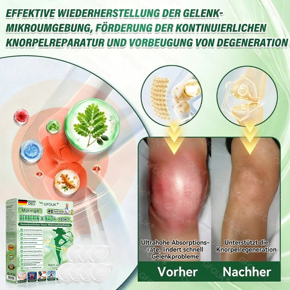 🇩🇪𝗢𝗳𝗳𝗶𝘇𝗶𝗲𝗹𝗹𝗲𝗿 𝗦𝗵𝗼𝗽 🏆| 🎁 𝗚𝗙𝗢𝗨𝗞® 𝗠𝗼𝗿𝗶𝗻𝗴𝗮 𝗕𝗲𝗿𝗯𝗲𝗿𝗶𝗻𝗲𝘅 𝗡𝗔𝗗+ 𝟭𝟬-𝗶𝗻-𝟭 𝗡𝗮𝗻𝗼-𝗠𝗶𝗸𝗿𝗼𝗻𝗮𝗱𝗲𝗹-𝗣𝗮𝘁𝗰𝗵 (𝗡𝘂𝗿 𝗲𝗶𝗻𝗺𝗮𝗹 𝘁ä𝗴𝗹𝗶𝗰𝗵, 𝘀𝗶𝗰𝗵𝘁𝗯𝗮𝗿𝗲 𝗩𝗲𝗿ä𝗻𝗱𝗲𝗿𝘂𝗻𝗴𝗲𝗻 𝗶𝗻 𝟳 𝗧𝗮𝗴𝗲𝗻) ✅ 𝗙ü𝗿 Ü𝗯𝗲𝗿𝗴𝗲𝘄𝗶𝗰𝗵𝘁, 𝗹𝗼𝗰𝗸𝗲𝗿𝗲 𝗛𝗮𝘂𝘁, 𝗗𝗶𝗮𝗯𝗲𝘁𝗲𝘀, 𝗦𝗰𝗵𝗹𝗮𝗳𝗮𝗽𝗻𝗼𝗲, 𝗚𝗲𝗹𝗲𝗻𝗸𝗽𝗿𝗼𝗯𝗹𝗲𝗺𝗲 𝘂𝗻𝗱 𝗺𝗲𝗵𝗿 - Image 17