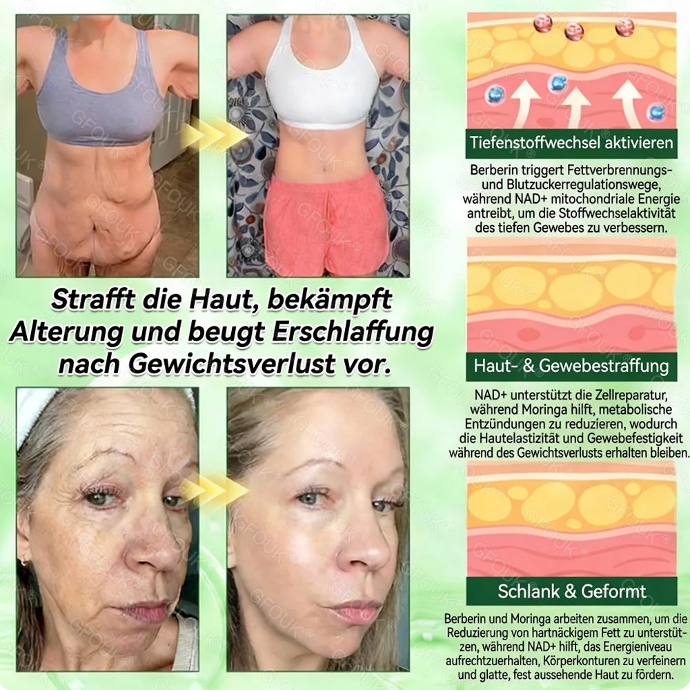🇩🇪Offizieller Shop 🌿|👨‍⚕️🛡️ 𝗚𝗙𝗢𝗨𝗞® 𝗠𝗼𝗿𝗶𝗻𝗴𝗮 𝗕𝗲𝗿𝗯𝗲𝗿𝗶𝗻𝗲𝘅 𝗡𝗔𝗗+ 𝟭𝟬-𝗶𝗻-𝟭 𝗡𝗮𝗻𝗼-𝗠𝗶𝗸𝗿𝗼𝗻𝗮𝗱𝗲𝗹-𝗣𝗮𝘁𝗰𝗵 (𝗡𝘂𝗿 𝗲𝗶𝗻𝗺𝗮𝗹 𝘁ä𝗴𝗹𝗶𝗰𝗵, 𝘀𝗶𝗰𝗵𝘁𝗯𝗮𝗿𝗲 𝗩𝗲𝗿ä𝗻𝗱𝗲𝗿𝘂𝗻𝗴𝗲𝗻 𝗶𝗻 𝟳 𝗧𝗮𝗴𝗲𝗻) ✅ 𝗙ü𝗿 Ü𝗯𝗲𝗿𝗴𝗲𝘄𝗶𝗰𝗵𝘁, 𝗹𝗼𝗰𝗸𝗲𝗿𝗲 𝗛𝗮𝘂𝘁, 𝗗𝗶𝗮𝗯𝗲𝘁𝗲𝘀, 𝗦𝗰𝗵𝗹𝗮𝗳𝗮𝗽𝗻𝗼𝗲, 𝗚𝗲𝗹𝗲𝗻𝗸𝗽𝗿𝗼𝗯𝗹𝗲𝗺𝗲 𝘂𝗻𝗱 𝗺𝗲𝗵𝗿⬇️ - Image 3