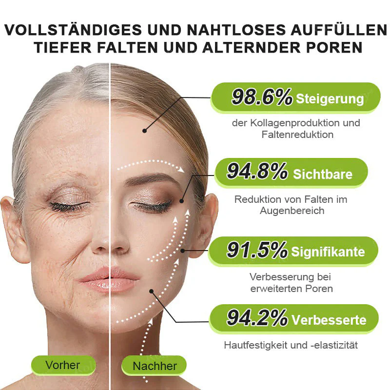 🇩🇪Jetzt jugendliche Haut zurückgewinnen💟Cvreoz® Botox & Vita-A Retinol Shot Falten-Lift Straffungscreme - Image 16