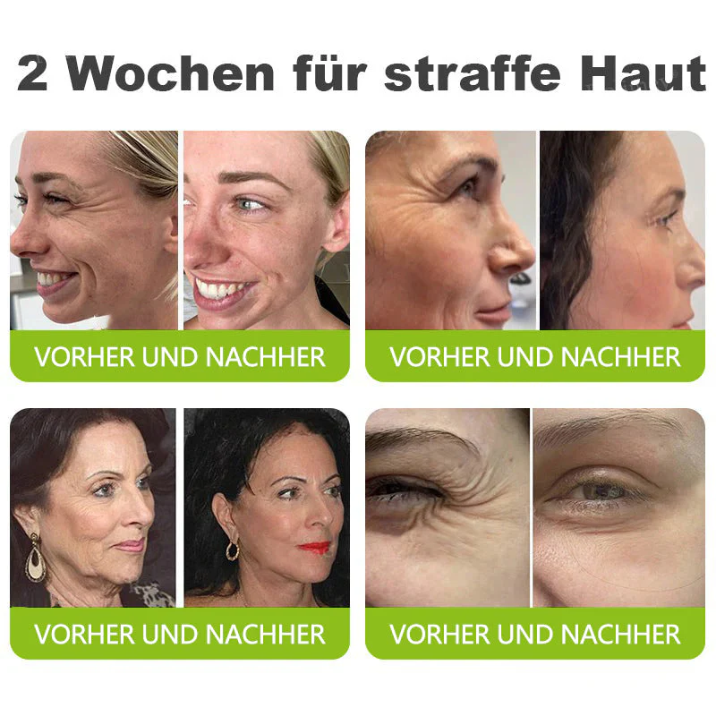 🇩🇪Jetzt jugendliche Haut zurückgewinnen💟Cvreoz® Botox & Vita-A Retinol Shot Falten-Lift Straffungscreme - Image 3