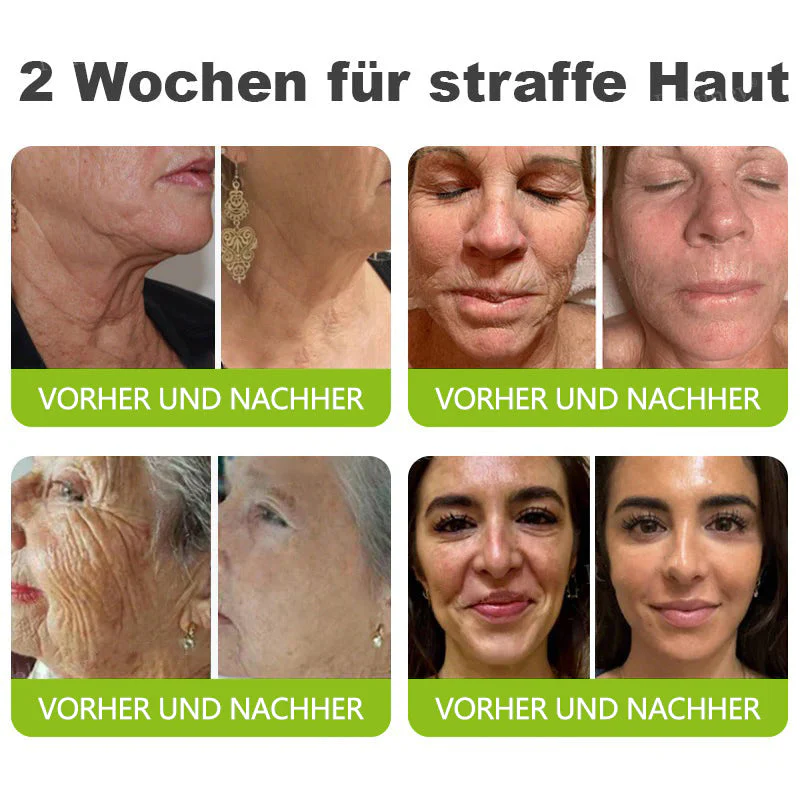 🇩🇪Jetzt jugendliche Haut zurückgewinnen💟Cvreoz® Botox & Vita-A Retinol Shot Falten-Lift Straffungscreme - Image 4