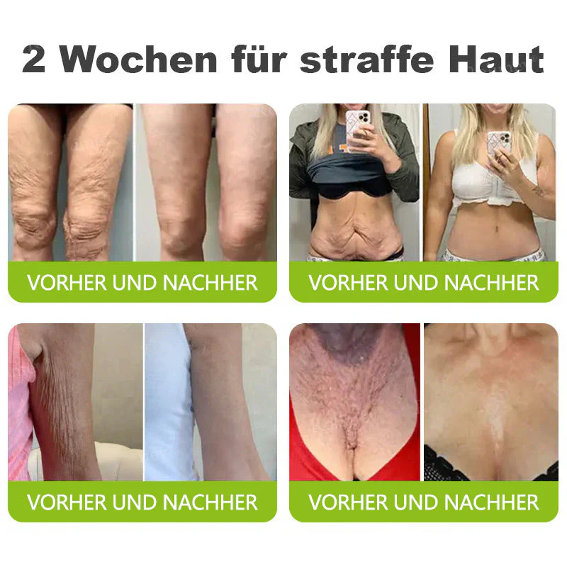 🇩🇪Jetzt jugendliche Haut zurückgewinnen💟Cvreoz® Botox & Vita-A Retinol Shot Falten-Lift Straffungscreme - Image 5