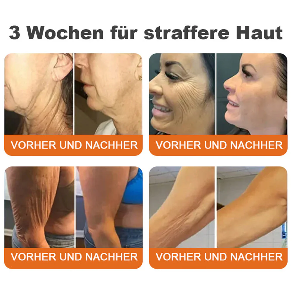 🌲🇩🇪Hergestellt in Deutschland🌲Rolimey® Botox-Bienenvergiftungsstraffungsserum-Stick🔥LETZTER TAG 70% RABATT - Image 2