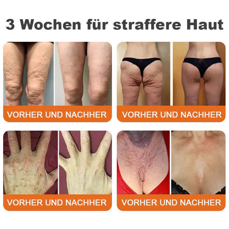 🌲🇩🇪Hergestellt in Deutschland🌲Rolimey® Botox-Bienenvergiftungsstraffungsserum-Stick🔥LETZTER TAG 70% RABATT - Image 4