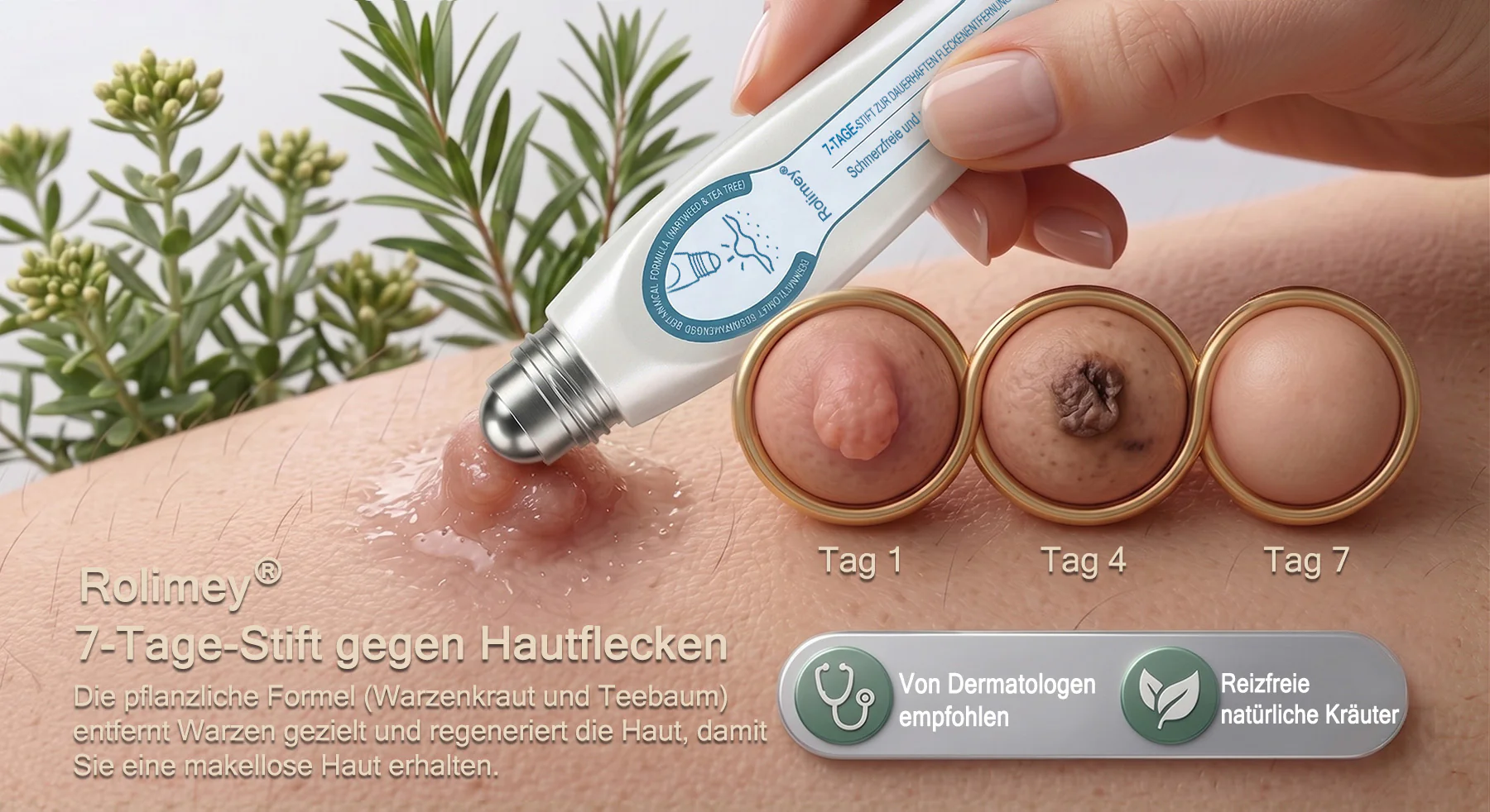 Rolimey® 7-Tage Tag- & Spot-Entferner🤍 (𝐙𝗲𝗿𝗼 𝐏𝗮𝗶𝗻, 𝐙𝗲𝗿𝗼 𝐒𝗰𝗮𝗿𝘀 Roll-On) ✅ Geeignet für: Hauttags, Flecken, Muttermale, Warzen, Blasen, Ekzeme, Schuppen, Hautkeratosen, Akne, Hautwucherungen, Narben, Geburtstagsmale 👩‍⚕️ - Image 2