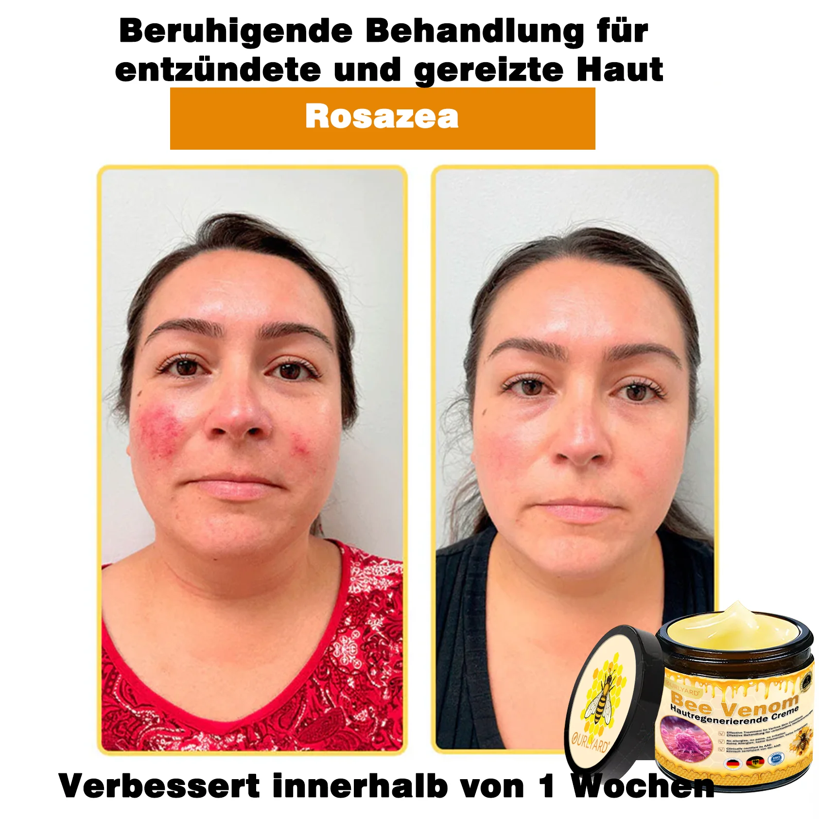🌙🌙Ourlyard® Bienengift Pro Umfassende Creme — 🔥Begrenzte Zeit 80 % RABATT🔥 - Image 5