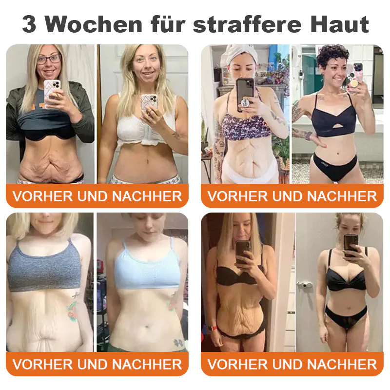 🇩🇪Hergestellt in Deutschland🍋‍🟩ROLIMEY® Botox-Bienenvergiftungsstraffungsserum-Stick🍃LETZTER TAG 70% RABATT - Image 5