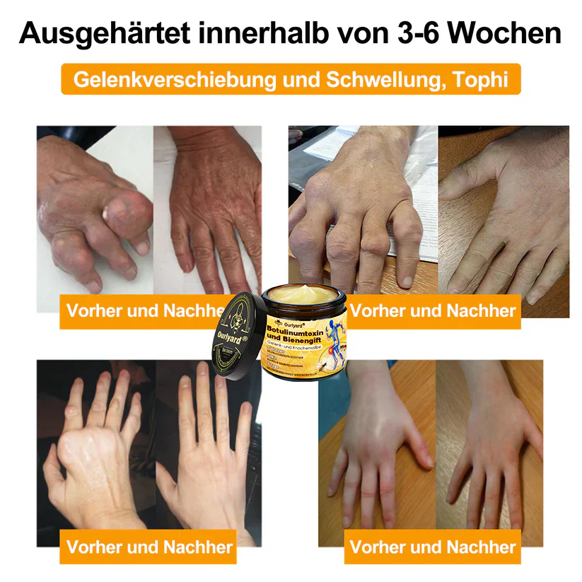 🇩🇪Offizieller Shop: Ourlyard® Bienengift-Schmerzlinderungs Knochenheilungs Creme 💥Deutsche orthopädische (DOUG) Zulassung(Reduzierung von Gelenkschwellungen, Schmerzen, Steifheit, Rötungen, Wärme, Muskelkater und Gelenkmüdigkeit) - Image 2
