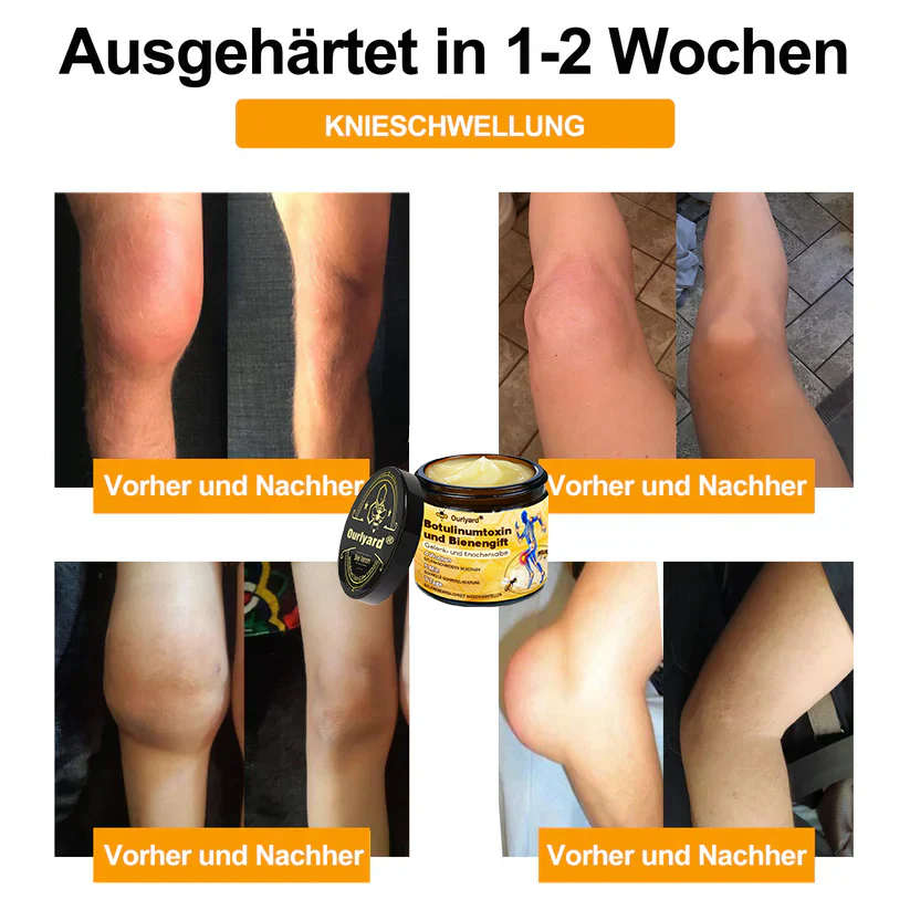 🇩🇪Offizieller Shop: Ourlyard® Bienengift-Schmerzlinderungs Knochenheilungs Creme 💥Deutsche orthopädische (DOUG) Zulassung(Reduzierung von Gelenkschwellungen, Schmerzen, Steifheit, Rötungen, Wärme, Muskelkater und Gelenkmüdigkeit) - Image 4