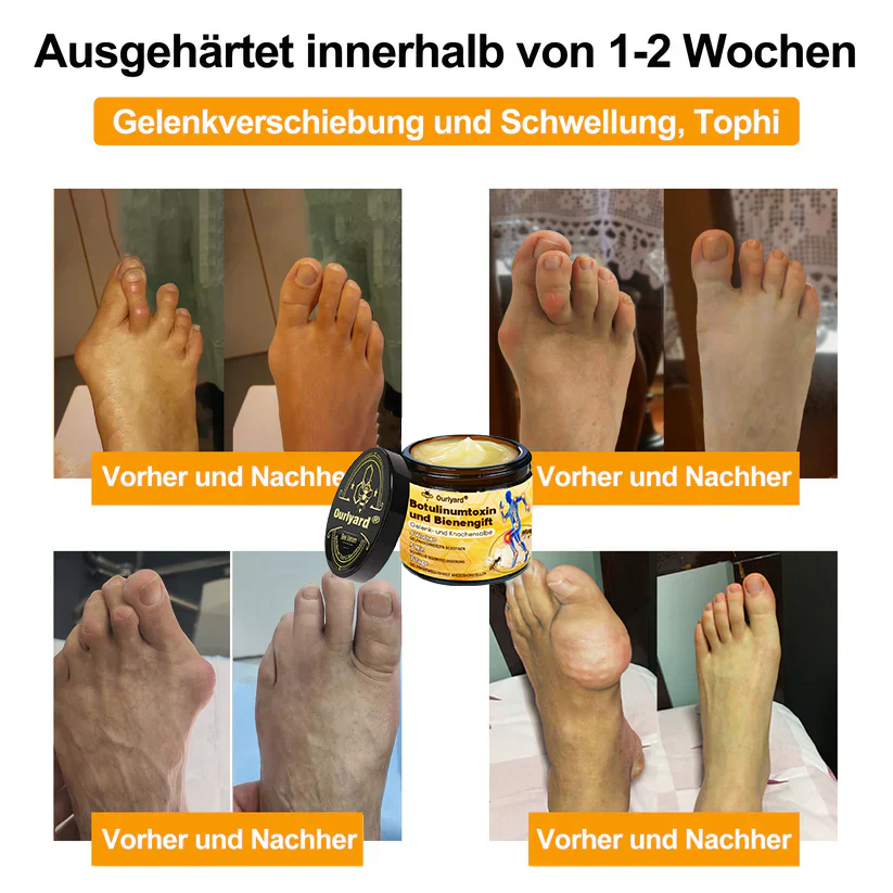 🇩🇪Offizieller Shop: Ourlyard® Bienengift-Schmerzlinderungs Knochenheilungs Creme 💥Deutsche orthopädische (DOUG) Zulassung(Reduzierung von Gelenkschwellungen, Schmerzen, Steifheit, Rötungen, Wärme, Muskelkater und Gelenkmüdigkeit) - Image 9