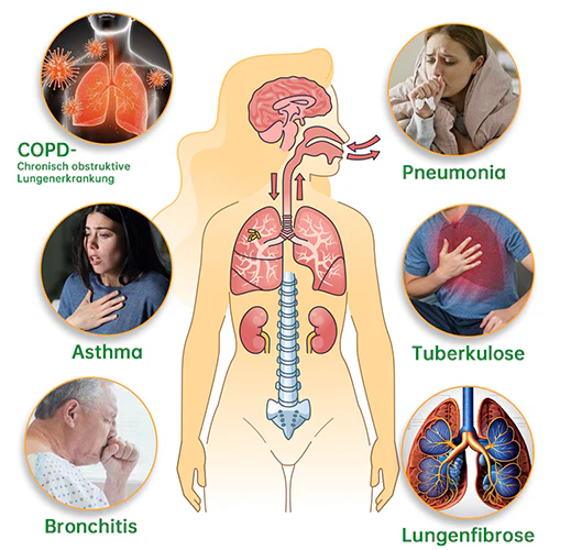 🍎Offizieller Shop|🔥Ourlyard™ Natürlicher Eukalyptus Lungenklar Inhalator 👨‍⚕️BfArM-certification(💝LETZTER TAG 50% RABATT 💝) - Image 4
