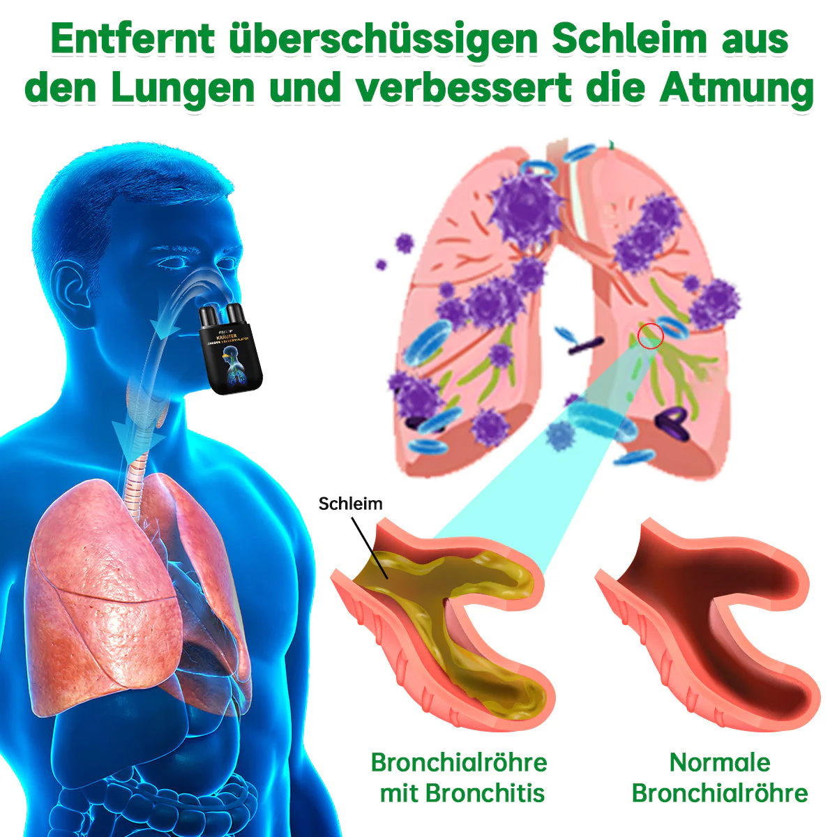 🥥👨⚕️Furzero™ Kräuter-Lungenreinigungsinhalator (💝 Empfohlen von führenden Lungenspezialisten 💝) - Image 3