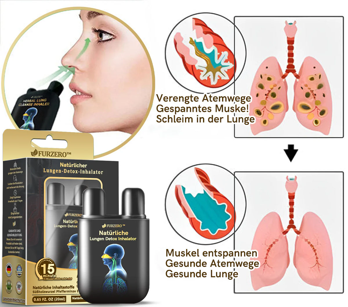 💖Offizieller Shop|🔥Furzero™ Natürlicher Lungen-Detox-Inhalator👨‍⚕️BfArM-certification(🎅 Weihnachts-Sonderangebot-💝LETZTER TAG 50% RABATT 💝) - Image 4