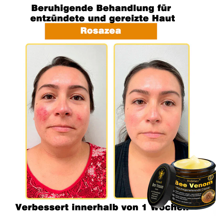 🎁🎁Neuestes Modell: Rolimey® Bienengift Max Pflegecreme – Reparatureffekt um 65 % gesteigert 🔥 NUR NOCH 80 % RABATT - Image 13