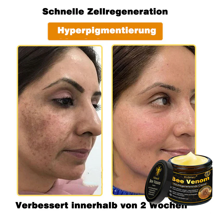 🎁🎁Neuestes Modell: Rolimey® Bienengift Max Pflegecreme – Reparatureffekt um 65 % gesteigert 🔥 NUR NOCH 80 % RABATT - Image 15