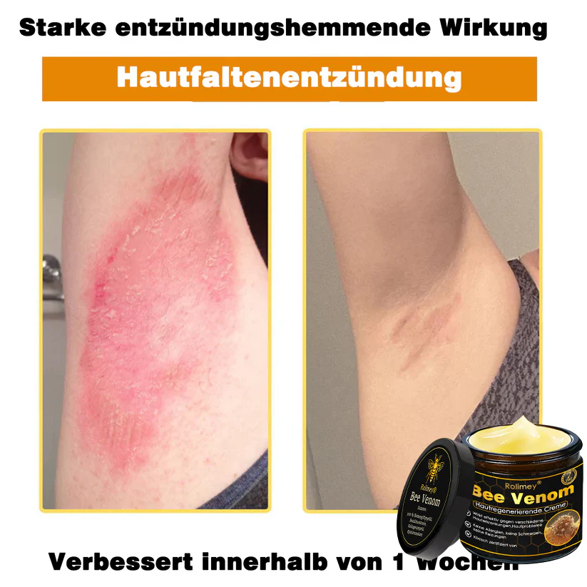 🎁🎁Neuestes Modell: Rolimey® Bienengift Max Pflegecreme – Reparatureffekt um 65 % gesteigert 🔥 NUR NOCH 80 % RABATT - Image 16