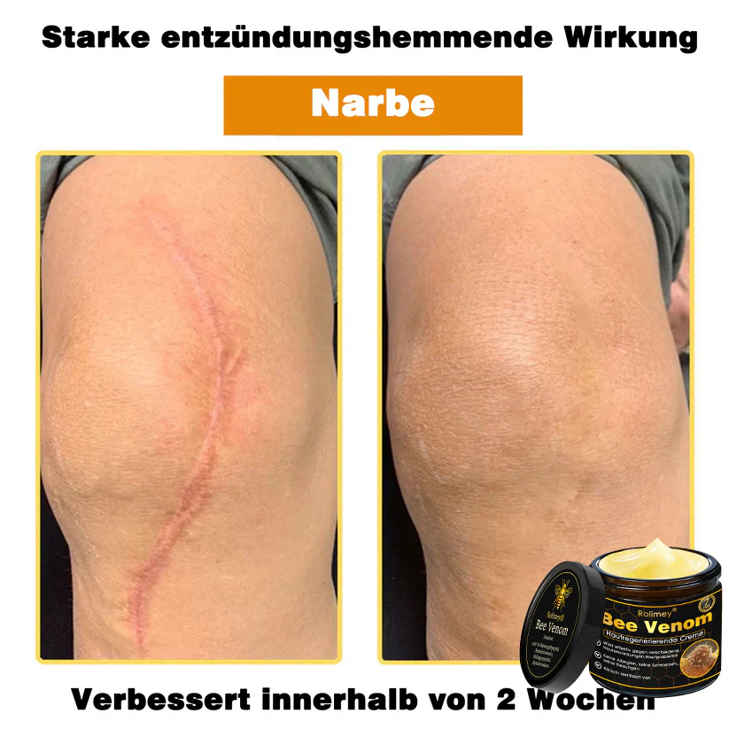 🎁🎁Neuestes Modell: Rolimey® Bienengift Max Pflegecreme – Reparatureffekt um 65 % gesteigert 🔥 NUR NOCH 80 % RABATT - Image 17