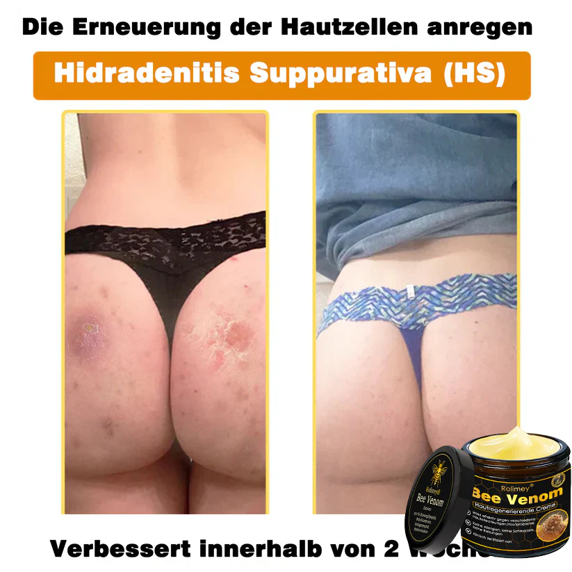 🎁🎁Neuestes Modell: Rolimey® Bienengift Max Pflegecreme – Reparatureffekt um 65 % gesteigert 🔥 NUR NOCH 80 % RABATT - Image 19