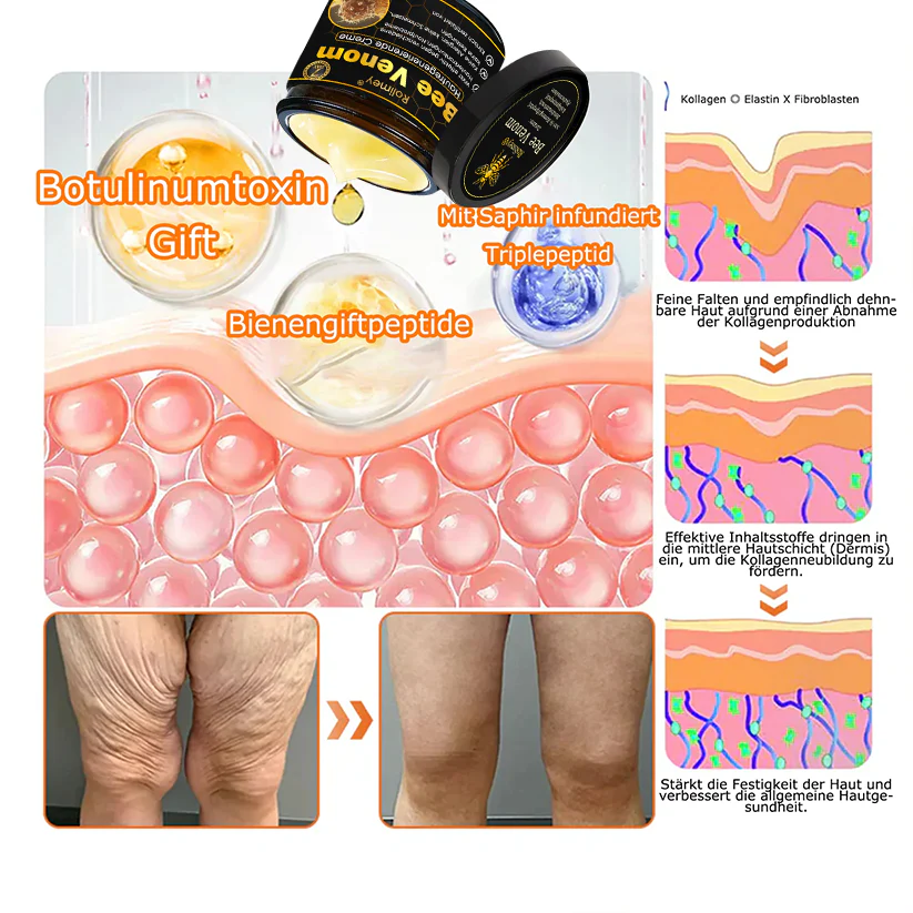 🎁🎁Neuestes Modell: Rolimey® Bienengift Max Pflegecreme – Reparatureffekt um 65 % gesteigert 🔥 NUR NOCH 80 % RABATT - Image 20