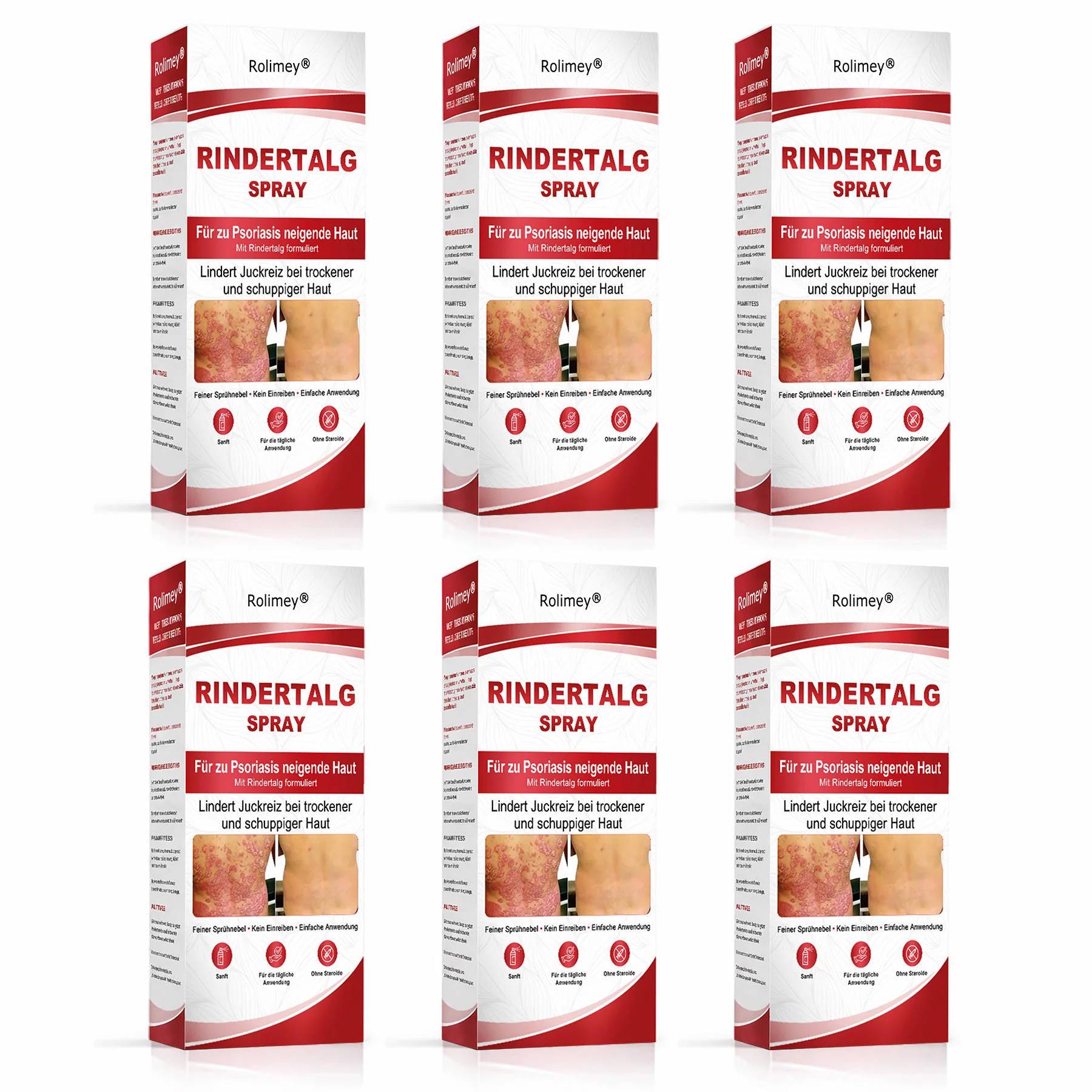 Rolimey® Rindertalg-Spray für juckende, schuppige Psoriasis-Haut 1 - Image 11