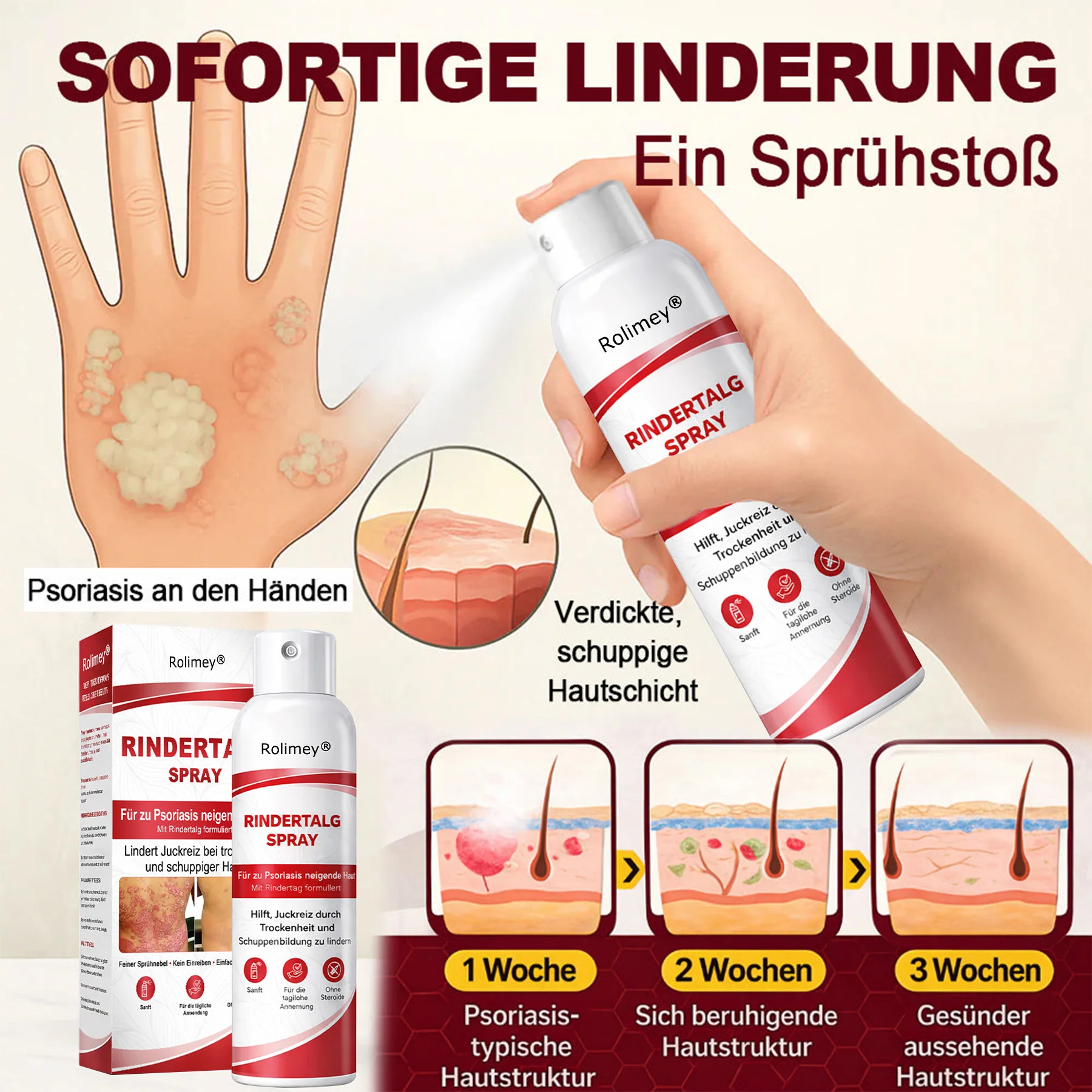 Rolimey® Rindertalg-Spray für juckende, schuppige Psoriasis-Haut 1 - Image 5