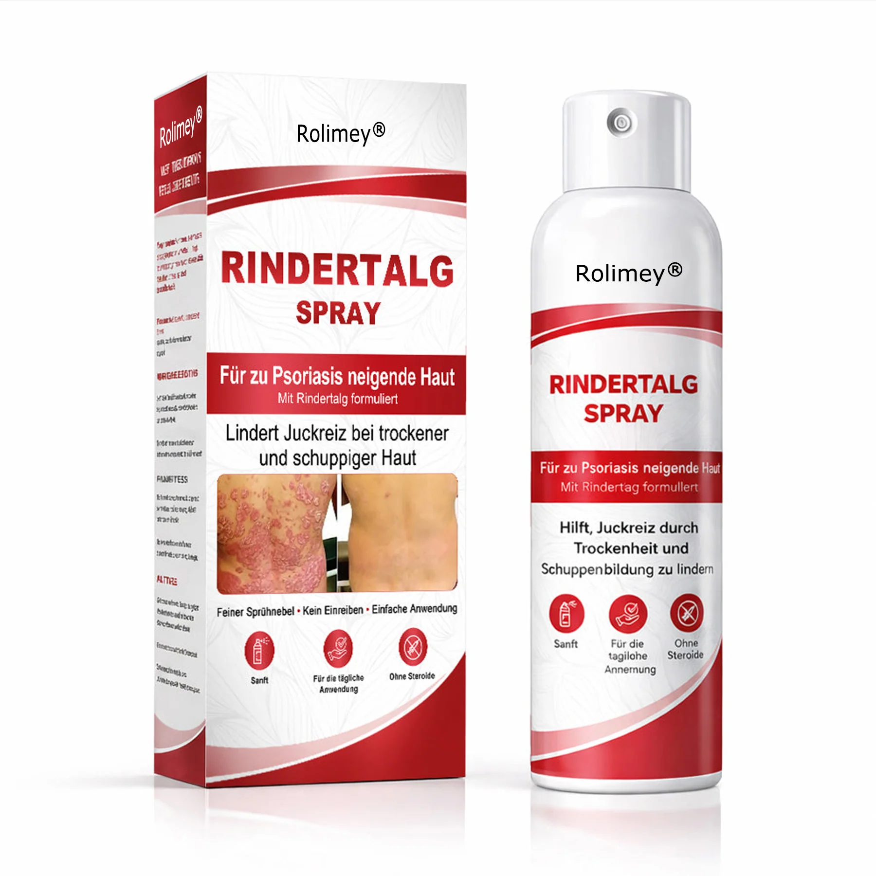 Rolimey® Rindertalg-Spray für juckende, schuppige Psoriasis-Haut 1 - Image 8