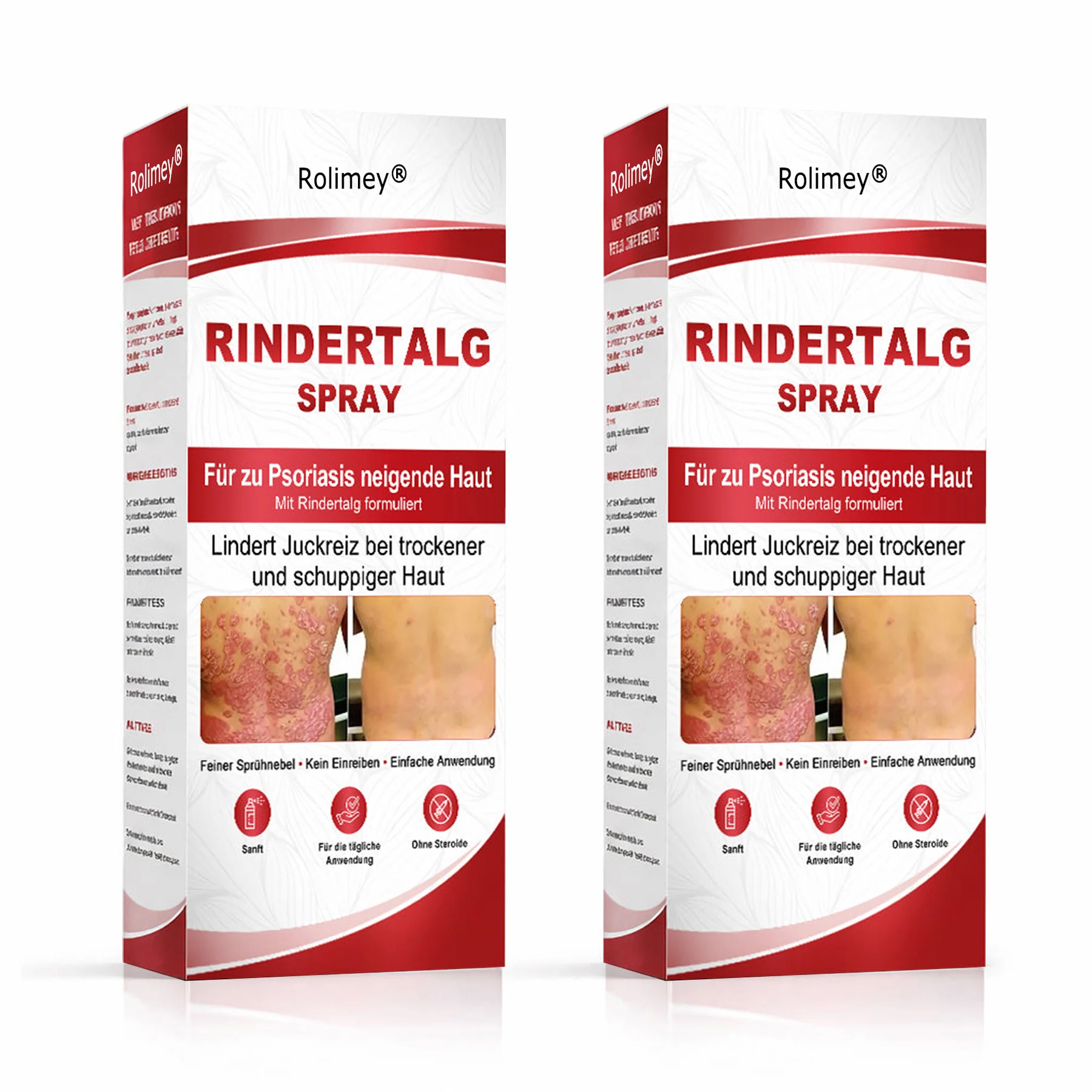 Rolimey® Rindertalg-Spray für juckende, schuppige Psoriasis-Haut 1 - Image 9