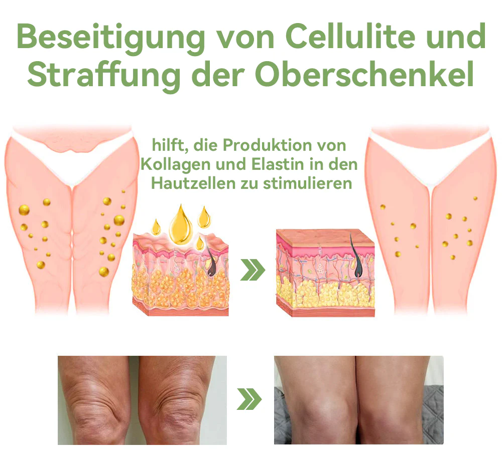 👩‍⚕🍓𝘚𝘛𝘋𝘌𝘐™ 𝘓𝘶𝘹𝘶𝘳𝘪ö𝘴𝘦 𝘒𝘰𝘭𝘭𝘢𝘨𝘦𝘯 𝘚𝘵𝘳𝘢𝘧𝘧𝘦𝘯𝘥𝘦 𝘊𝘳𝘦𝘮𝘦(🔥74% 𝘙𝘢𝘣𝘢𝘵𝘵 𝘧ü𝘳 𝘦𝘪𝘯𝘦 𝘣𝘦𝘨𝘳𝘦𝘯𝘻𝘵𝘦 𝘡𝘦𝘪𝘵!)💥💥💥 - Image 7