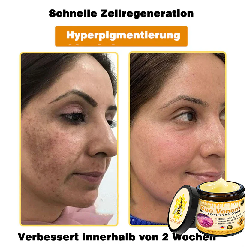 🎁Rolimey® Bienengift Hautregenerierende Creme — 🔥Begrenzte Zeit 80 % RABATT🔥 - Image 10