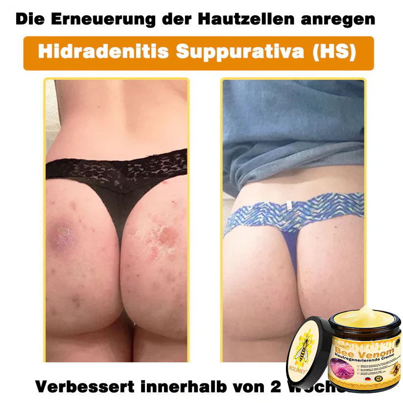 🎁Rolimey® Bienengift Hautregenerierende Creme — 🔥Begrenzte Zeit 80 % RABATT🔥 - Image 14