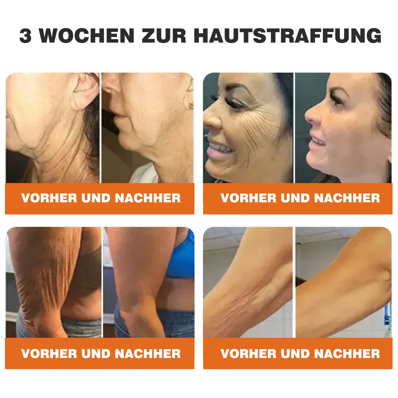 🎁🎁Neuestes Modell: Rolimey® Bienengift Max Pflegecreme – Reparatureffekt um 65 % gesteigert 🔥 NUR NOCH 80 % RABATT - Image 7