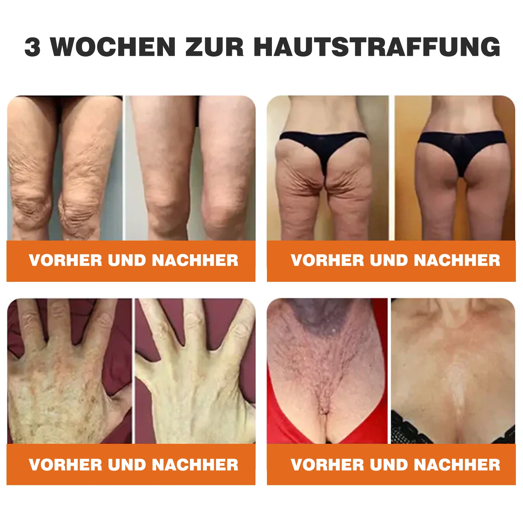 🎁🎁Neuestes Modell: Rolimey® Bienengift Max Pflegecreme – Reparatureffekt um 65 % gesteigert 🔥 NUR NOCH 80 % RABATT - Image 9