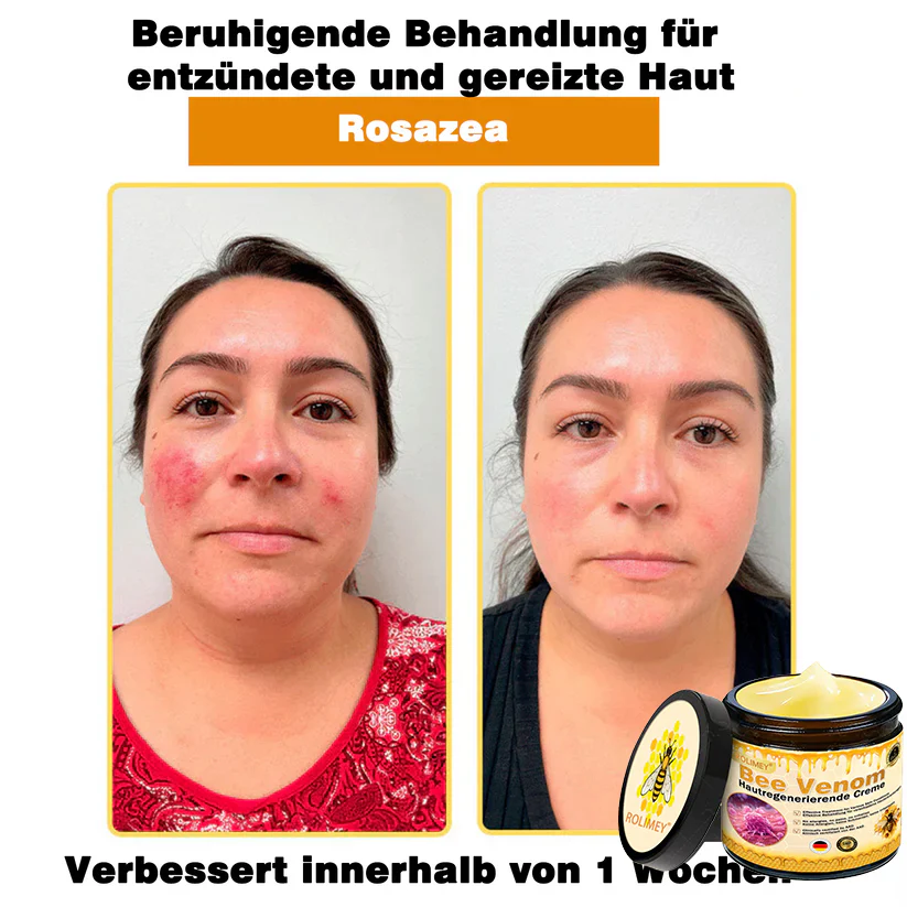🎁Rolimey® Bienengift Hautregenerierende Creme — 🔥Begrenzte Zeit 80 % RABATT🔥 - Image 9