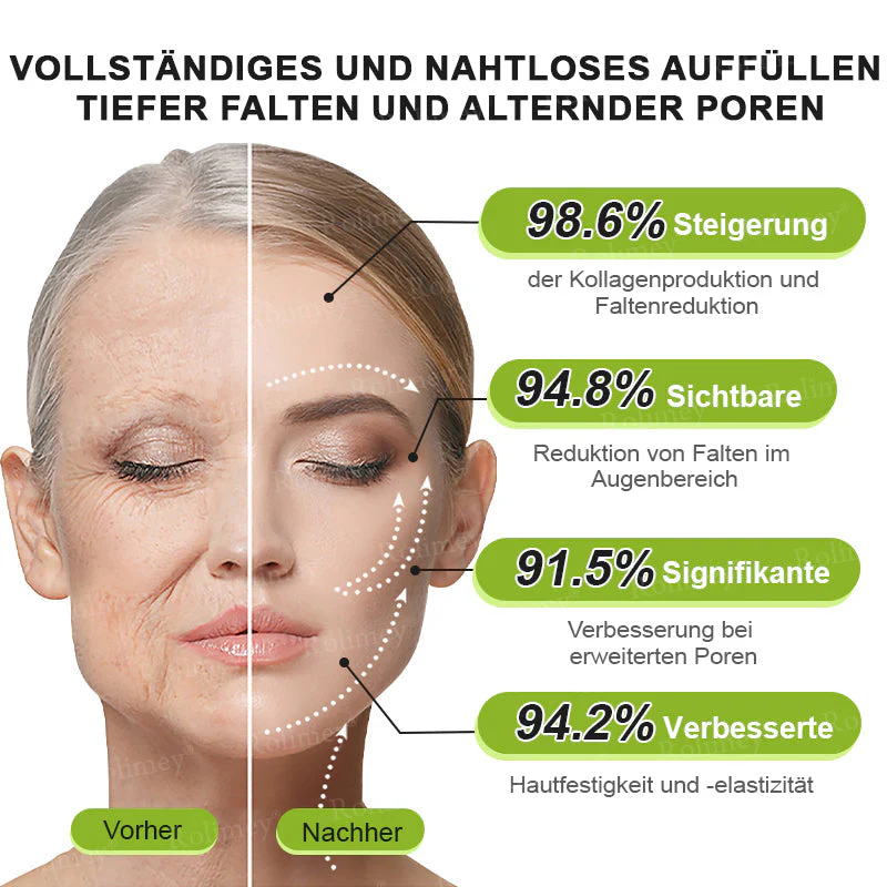 ✅Jetzt jugendliche Haut zurückgewinnen 💫Rolimey® Botox & Vita-A Retinol Shot Falten-Lift Straffungscreme - Image 16
