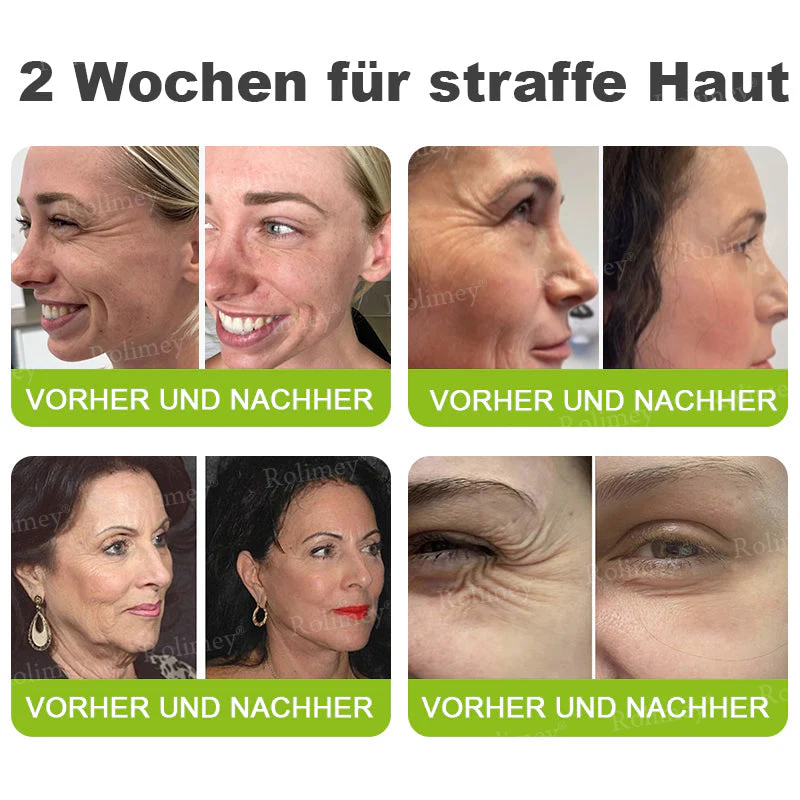 ✅Jetzt jugendliche Haut zurückgewinnen 💫Rolimey® Botox & Vita-A Retinol Shot Falten-Lift Straffungscreme - Image 6