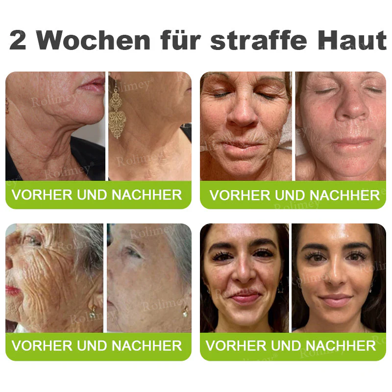 ✅Jetzt jugendliche Haut zurückgewinnen 💫Rolimey® Botox & Vita-A Retinol Shot Falten-Lift Straffungscreme - Image 8