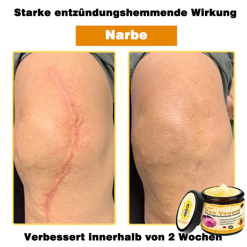 💎Rolimey® Bienengift Pro Umfassende Creme — 🔥Begrenzte Zeit 80 % RABATT🔥 - Image 15