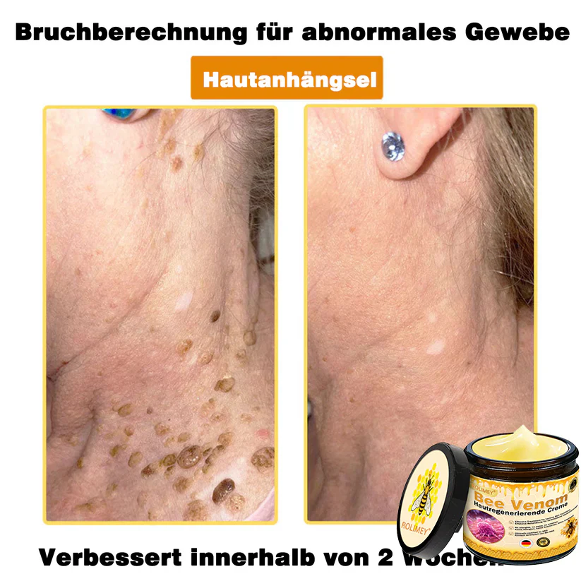 💎Rolimey® Bienengift Pro Umfassende Creme — 🔥Begrenzte Zeit 80 % RABATT🔥 - Image 16